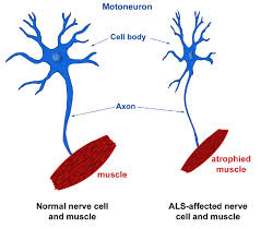 als nerve